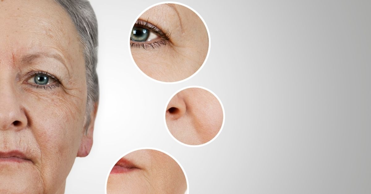 Anti-Wrinkle Treatments A Beginners Guide